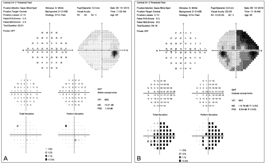 Fields Plot